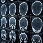 Embracing Technology In Your Brain Injury Case