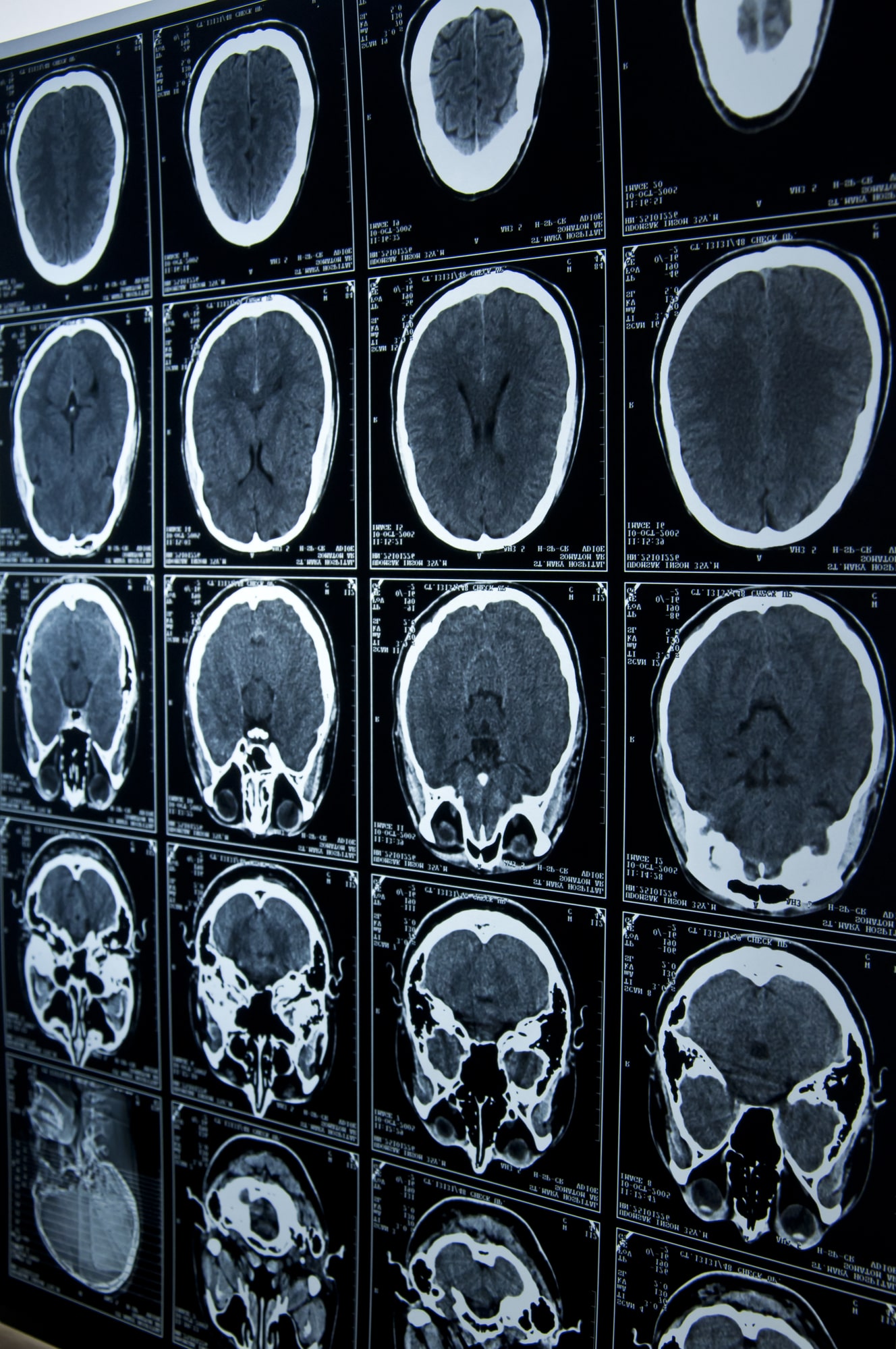 Read more about the article Embracing Technology In Your Brain Injury Case